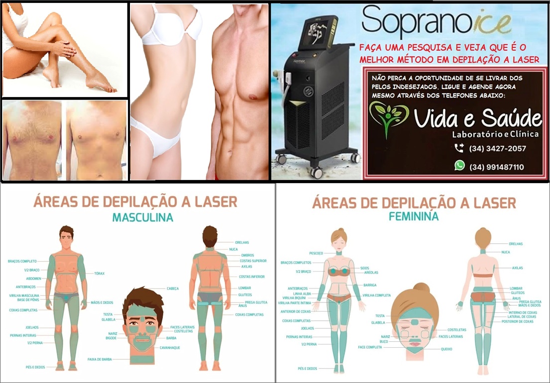 DEPILAÇÃO A LASER